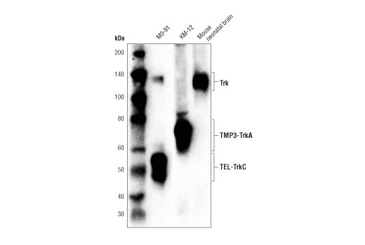  Image 12: TrkA and TrkB Antibody Sampler Kit
