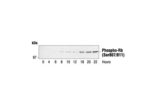  Image 6: PhosphoPlus® Rb (Ser780, Ser795, Ser807/811) Antibody Kit