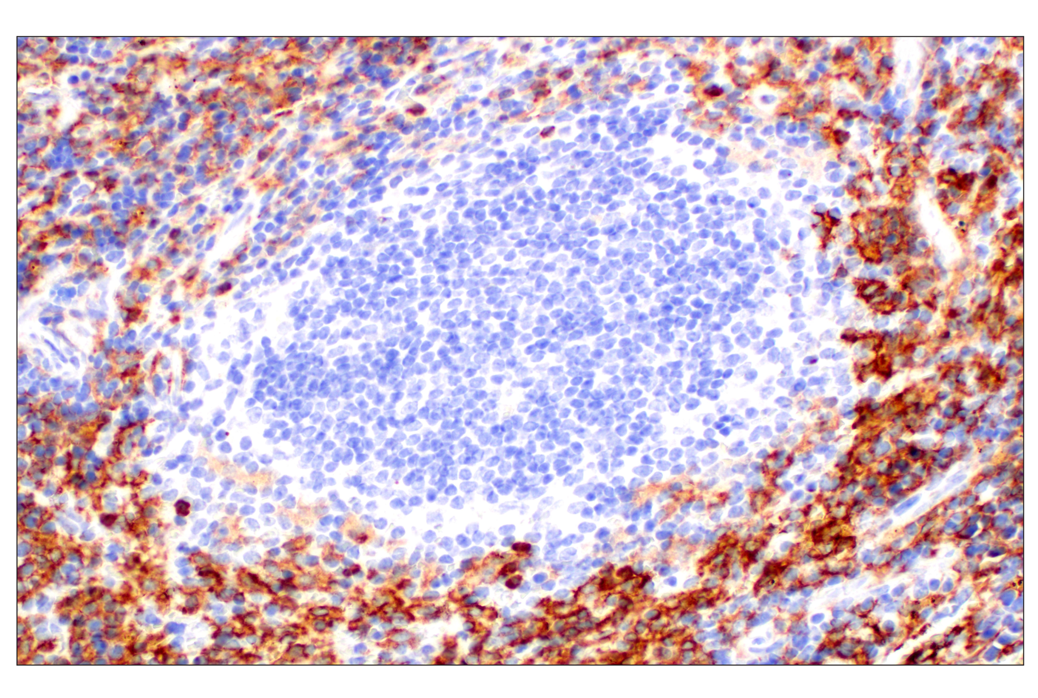 Immunohistochemistry Image 5: CD11b/ITGAM (E4K8C) Rabbit mAb