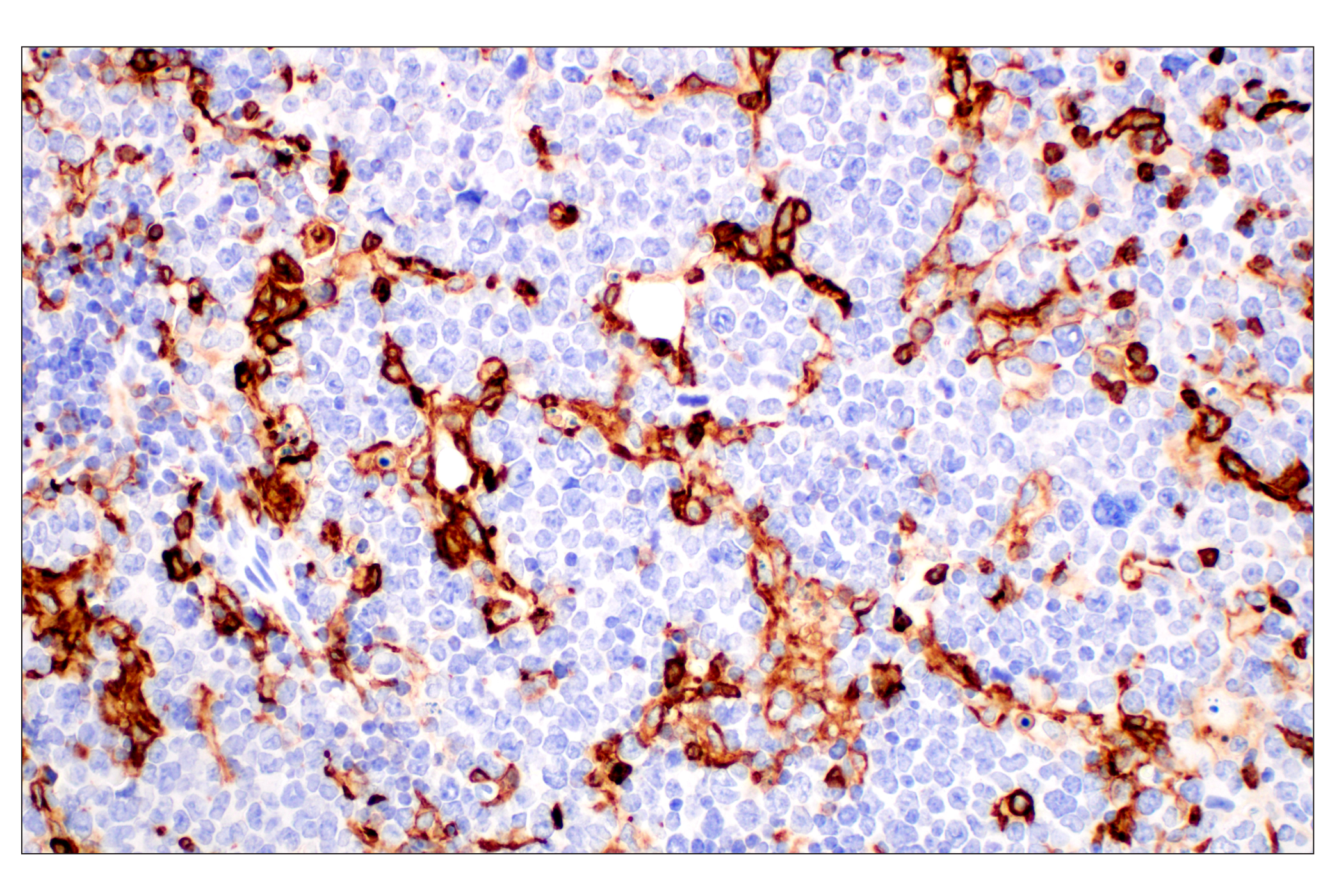 Immunohistochemistry Image 1: CD11b/ITGAM (E4K8C) Rabbit mAb