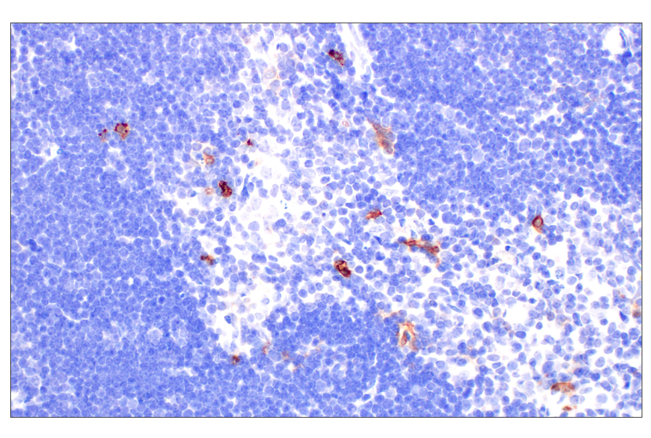 Immunohistochemistry Image 9: CD11b/ITGAM (E4K8C) Rabbit mAb