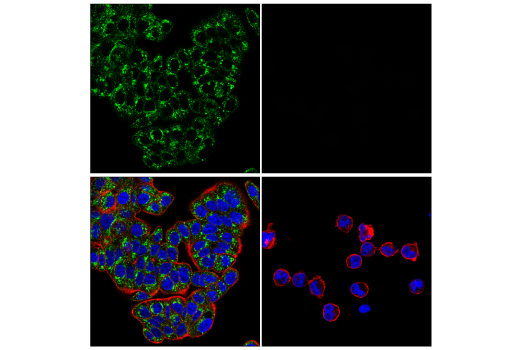 Immunofluorescence Image 1: TMEM106B (E7H7Z) Rabbit mAb