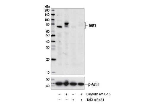 Western Blotting Image 1: Phospho-TAK1 (Ser412) Antibody