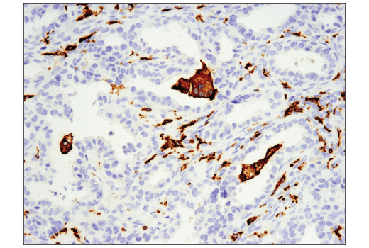 Immunohistochemistry Image 2: CD163 (D6U1J) Rabbit mAb