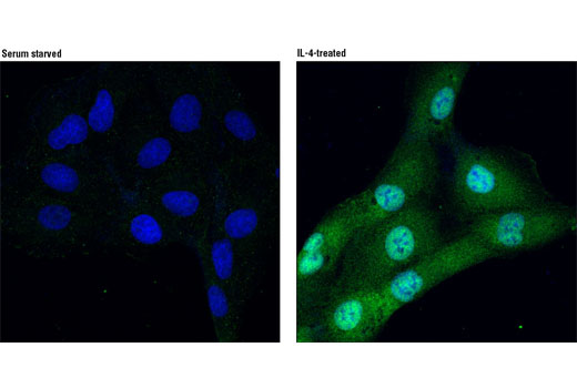 Immunofluorescence Image 1: Phospho-Stat6 (Tyr641) Antibody
