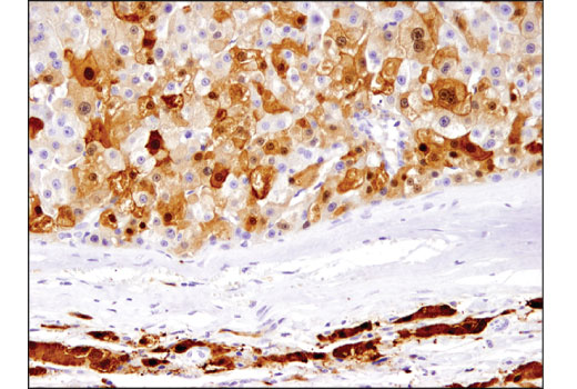  Image 30: Mouse Reactive M1 vs M2 Macrophage IHC Antibody Sampler Kit