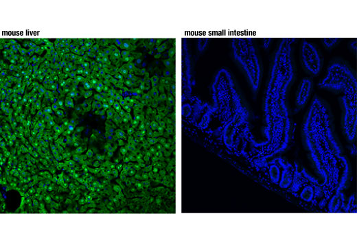 Immunofluorescence Image 1: Arginase-1 (D4E3M™) XP® Rabbit mAb