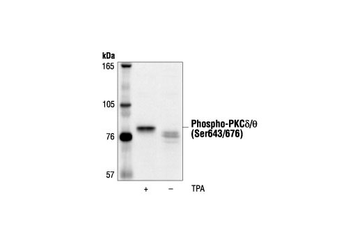 Western Blotting Image 1: Phospho-PKCδ/θ (Ser643/676) Antibody