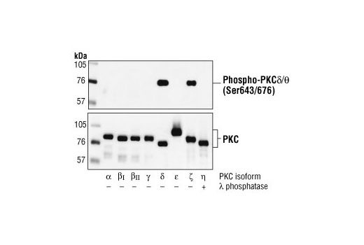 Western Blotting Image 2: Phospho-PKCδ/θ (Ser643/676) Antibody