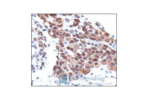  Image 19: Phospho-PKC Antibody Sampler Kit
