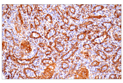 Immunohistochemistry Image 9: Integrin α1/CD49a (E9K2J) XP® Rabbit mAb (BSA and Azide Free)