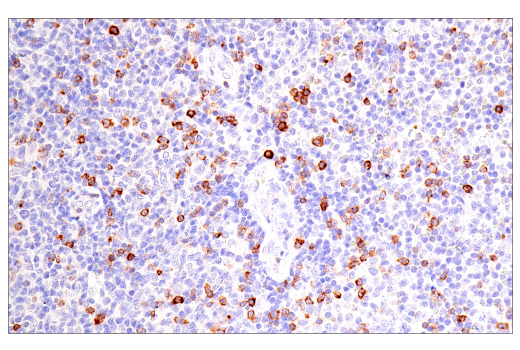 Immunohistochemistry Image 5: CD7 (LP15) Mouse mAb