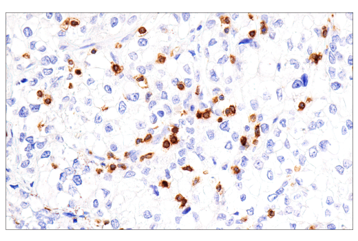 Immunohistochemistry Image 4: CD7 (LP15) Mouse mAb