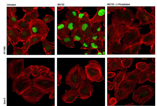 Immunofluorescence Image 1: Phospho-Cyclin D1 (Thr286) (D29B3) XP® Rabbit mAb (BSA and Azide Free)