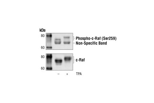  Image 8: Phospho-Akt Pathway Antibody Sampler Kit