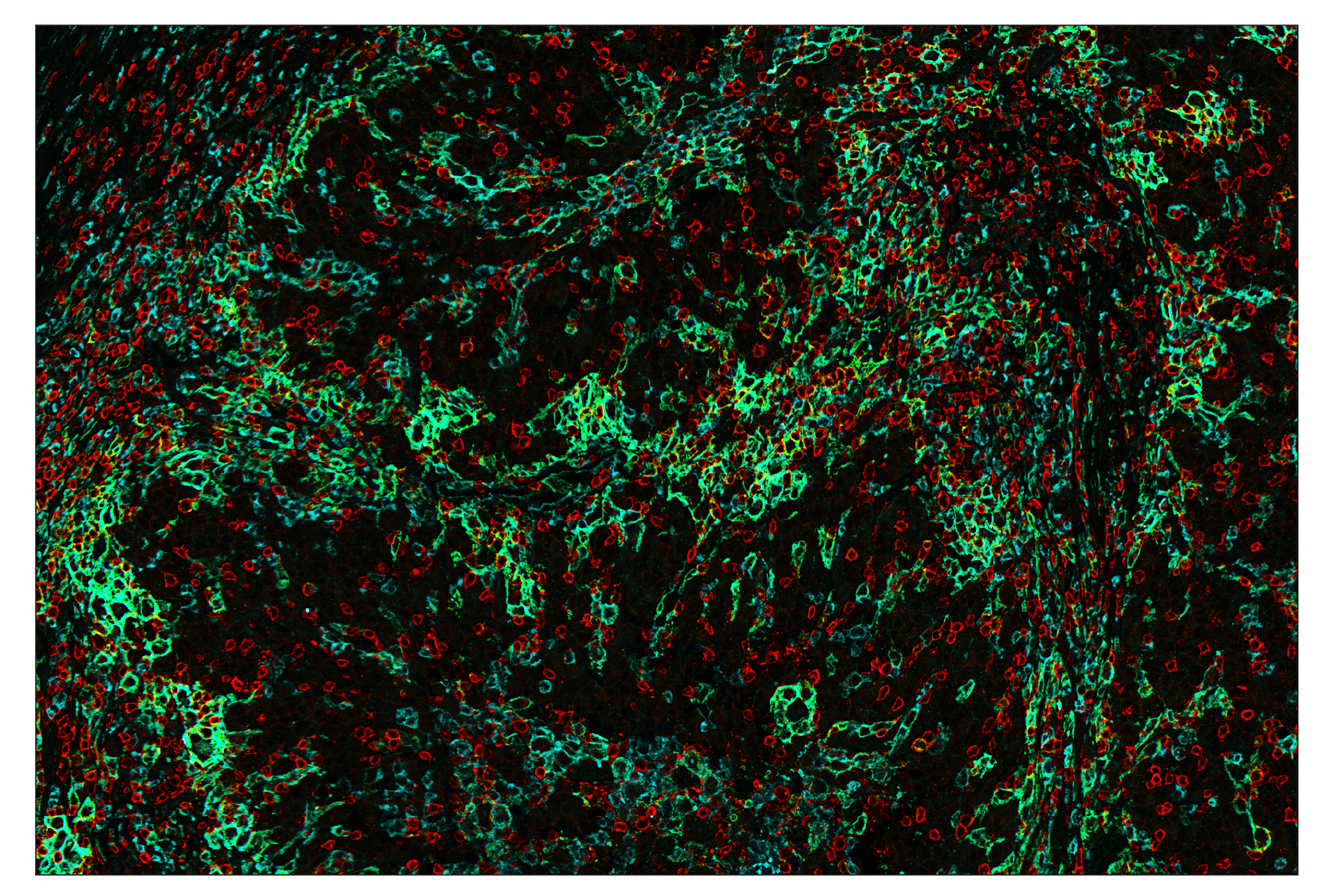 Immunohistochemistry Image 7: CD11c (D3V1E) & CO-0017-488 SignalStar™ Oligo-Antibody Pair