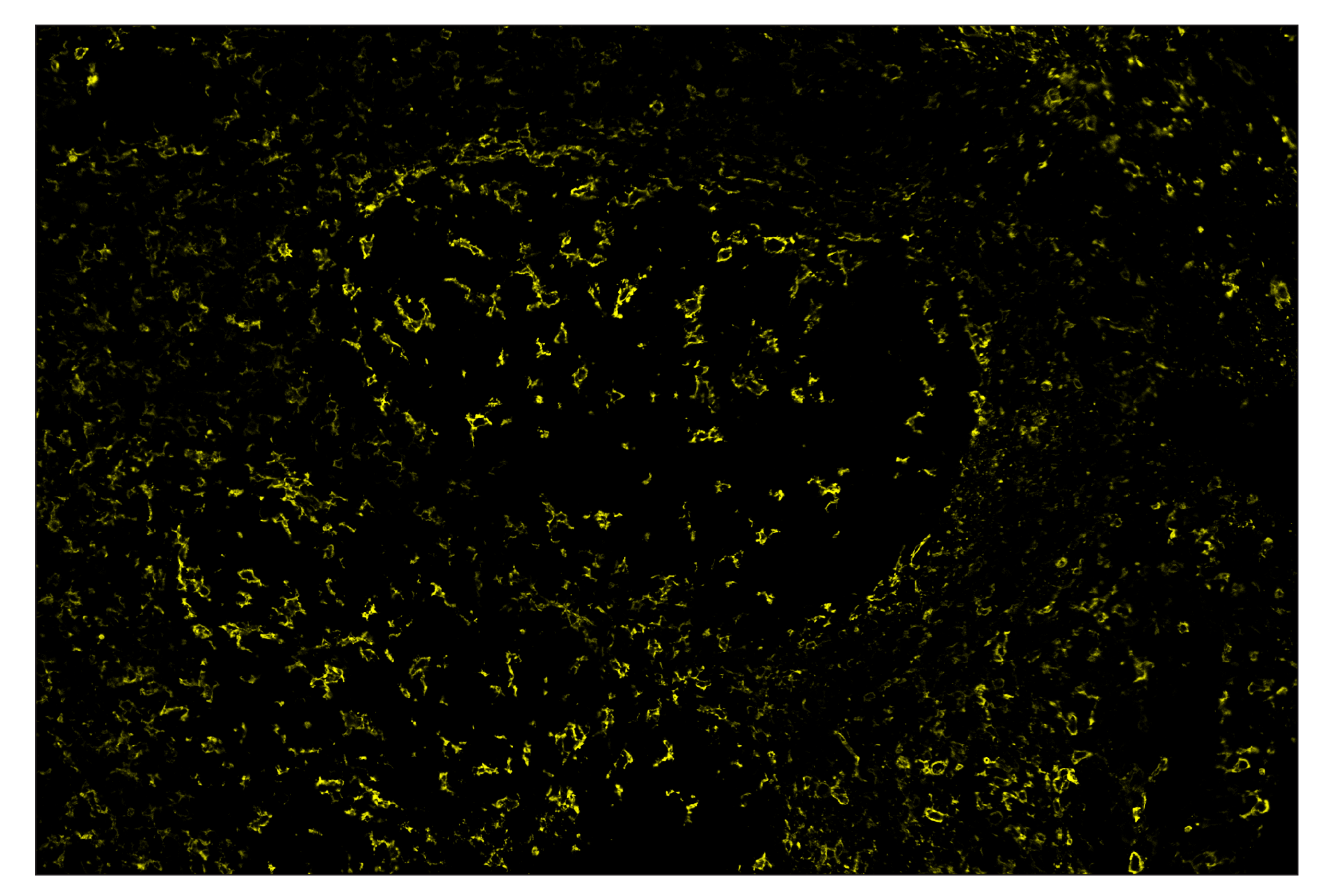 Immunohistochemistry Image 3: CD11c (D3V1E) & CO-0017-750 SignalStar™ Oligo-Antibody Pair