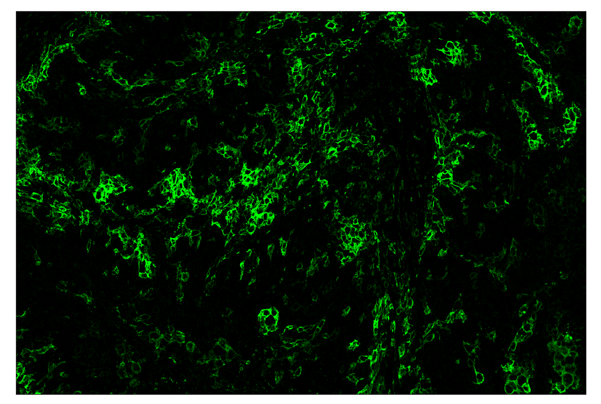 Immunohistochemistry Image 2: CD11c (D3V1E) & CO-0017-750 SignalStar™ Oligo-Antibody Pair