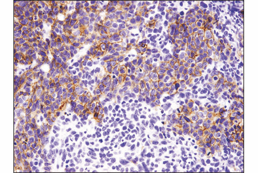 Immunohistochemistry Image 2: E-Cadherin (4A2) Mouse mAb (BSA and Azide Free)
