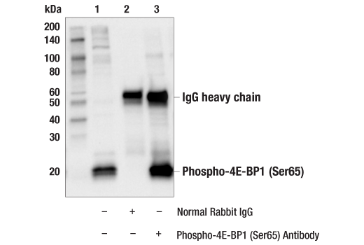 Immunoprecipitation Image 1: Phospho-4E-BP1 (Ser65) Antibody