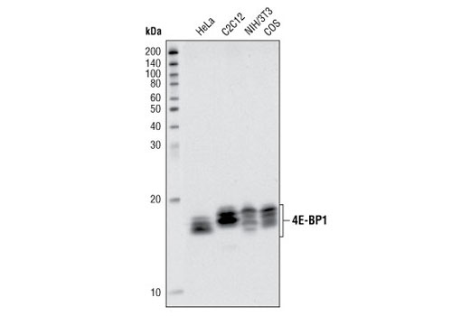 Western Blotting Image 2: 4E-BP1 Antibody