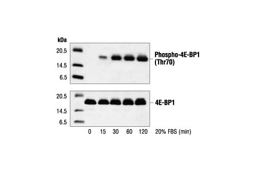 Western Blotting Image 1: Phospho-4E-BP1 (Thr70) Antibody