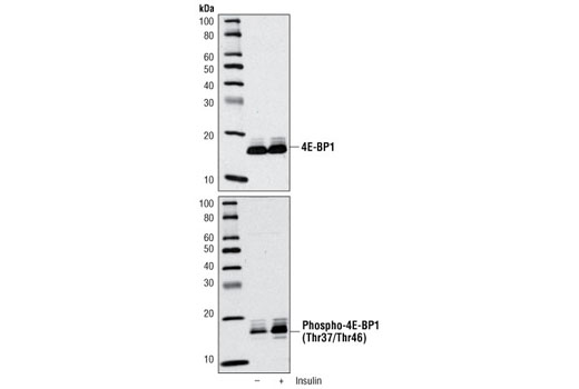 Western Blotting Image 1: Phospho-4E-BP1 (Thr37/46) Antibody