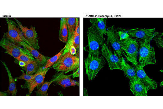 Immunofluorescence Image 1: Phospho-S6 Ribosomal Protein (Ser240/244) (D68F8) XP® Rabbit mAb (Alexa Fluor® 594 Conjugate)