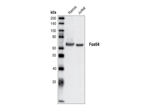  Image 9: Forkhead Signaling Antibody Sampler Kit