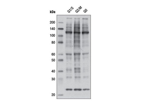  Image 5: Phospho-(Ser/Thr) Kinase Substrate Antibody Sampler Kit