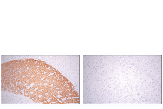 Immunohistochemistry Image 2: Adora2a/Adenosine Receptor A2a (E5I8X) XP® Rabbit mAb