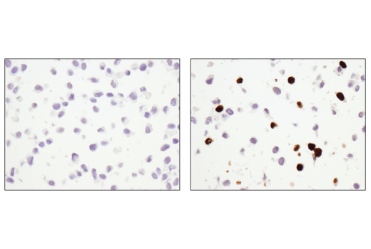  Image 28: Mouse Reactive Cell Death and Autophagy Antibody Sampler Kit