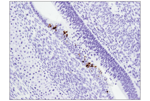  Image 34: Mouse Reactive Cell Death and Autophagy Antibody Sampler Kit
