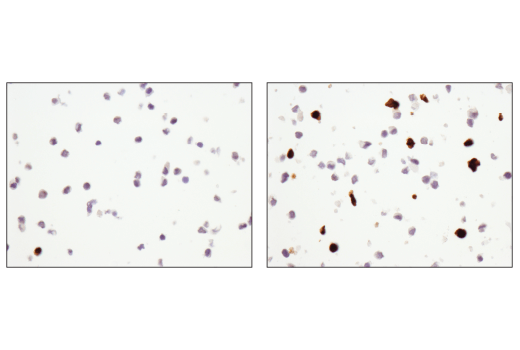  Image 38: Mouse Reactive Cell Death and Autophagy Antibody Sampler Kit