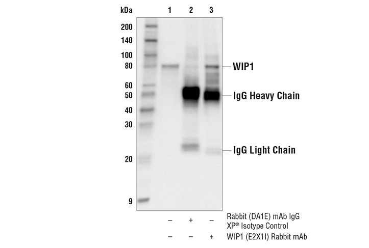 Immunoprecipitation Image 1: WIP1 (E2X1I) Rabbit mAb