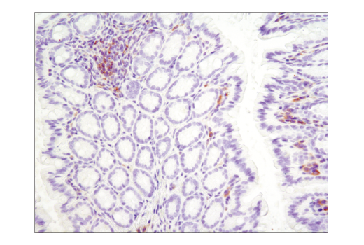Immunohistochemistry Image 3: Btk (D3H5) Rabbit mAb (BSA and Azide Free)