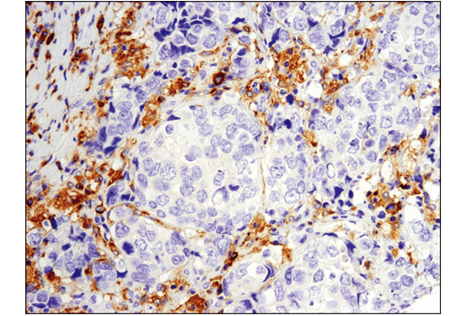 Immunohistochemistry Image 1: Btk (D3H5) Rabbit mAb (BSA and Azide Free)