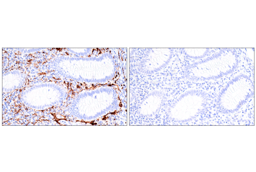 Immunohistochemistry Image 10: Calretinin (CAL6) Mouse mAb