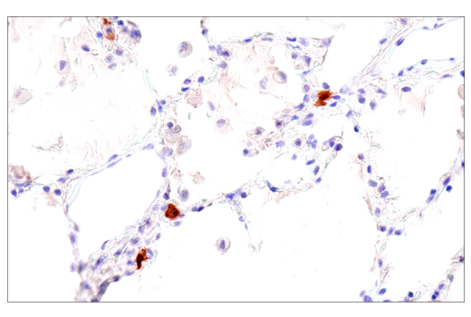 Immunohistochemistry Image 7: Calretinin (CAL6) Mouse mAb