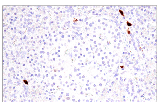 Immunohistochemistry Image 8: Calretinin (CAL6) Mouse mAb