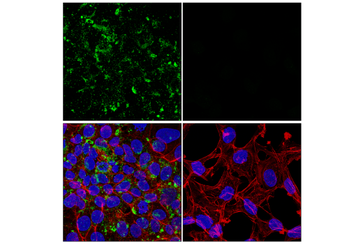Immunofluorescence Image 1: Perilipin-2 (E6G6M) Rabbit mAb