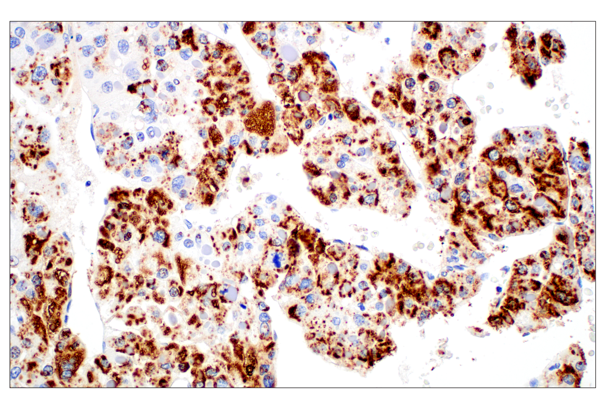 Immunohistochemistry Image 6: Perilipin-2 (E6G6M) Rabbit mAb