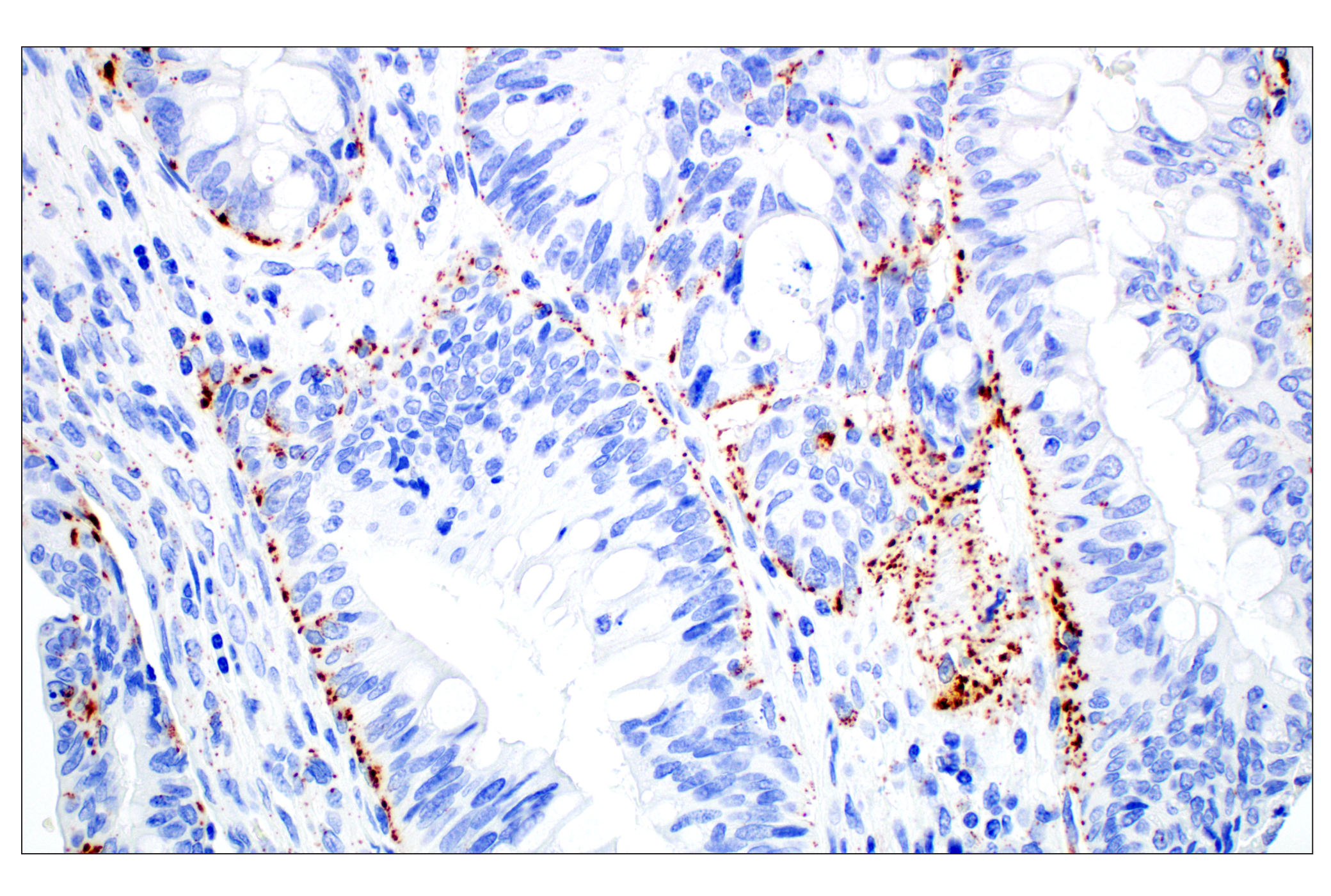 Immunohistochemistry Image 5: Perilipin-2 (E6G6M) Rabbit mAb