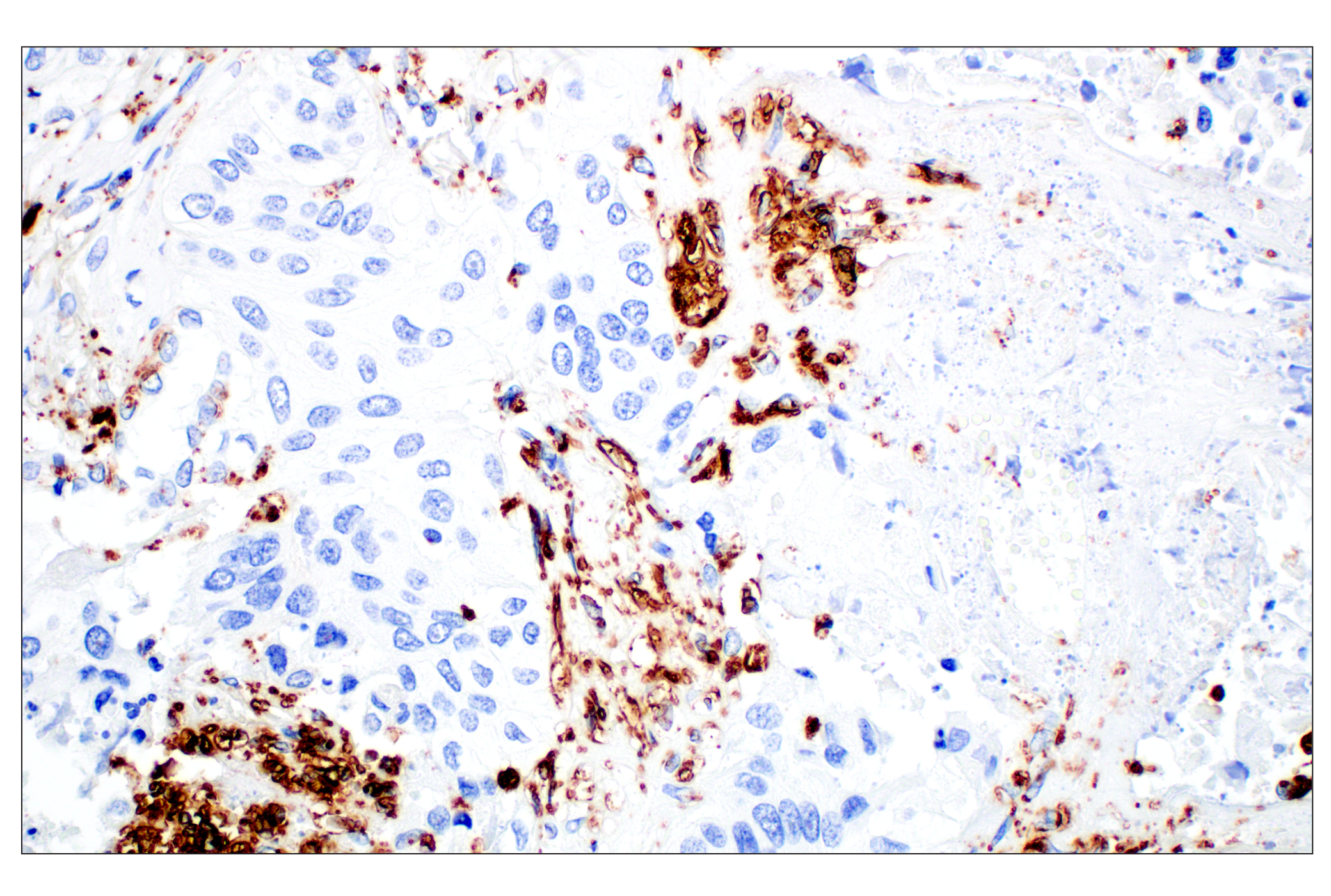 Immunohistochemistry Image 2: Perilipin-2 (E6G6M) Rabbit mAb
