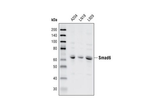 Western Blotting Image 1: Smad6 Antibody