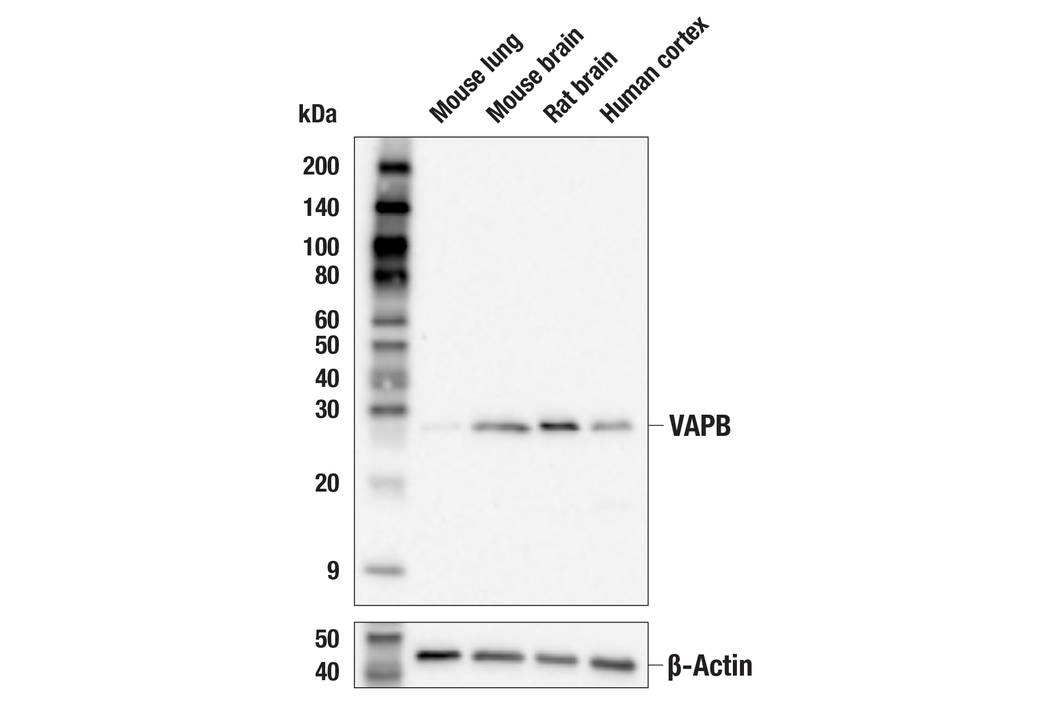 Western Blotting Image 1: VAPB (E7R3Z) Rabbit mAb