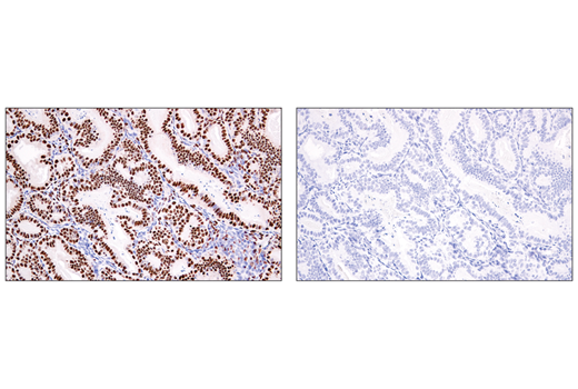 Immunohistochemistry Image 3: ADAR1 (E6X9R) XP® Rabbit mAb (BSA and Azide Free)