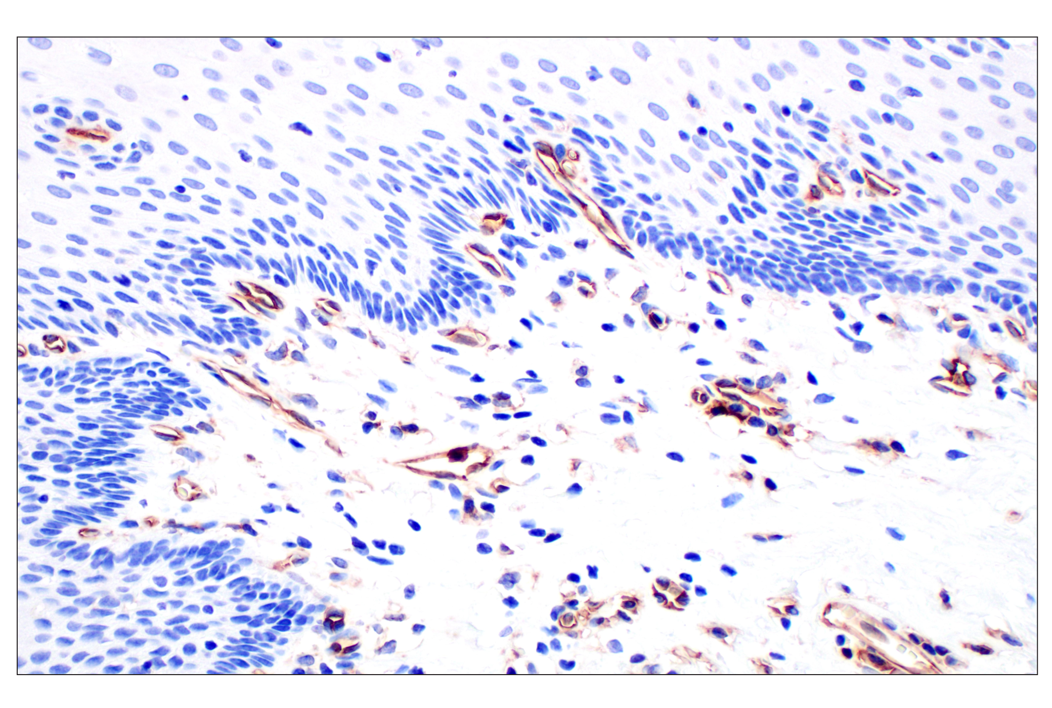 Immunohistochemistry Image 10: CD31 (PECAM-1) (F8M3S) Rabbit mAb