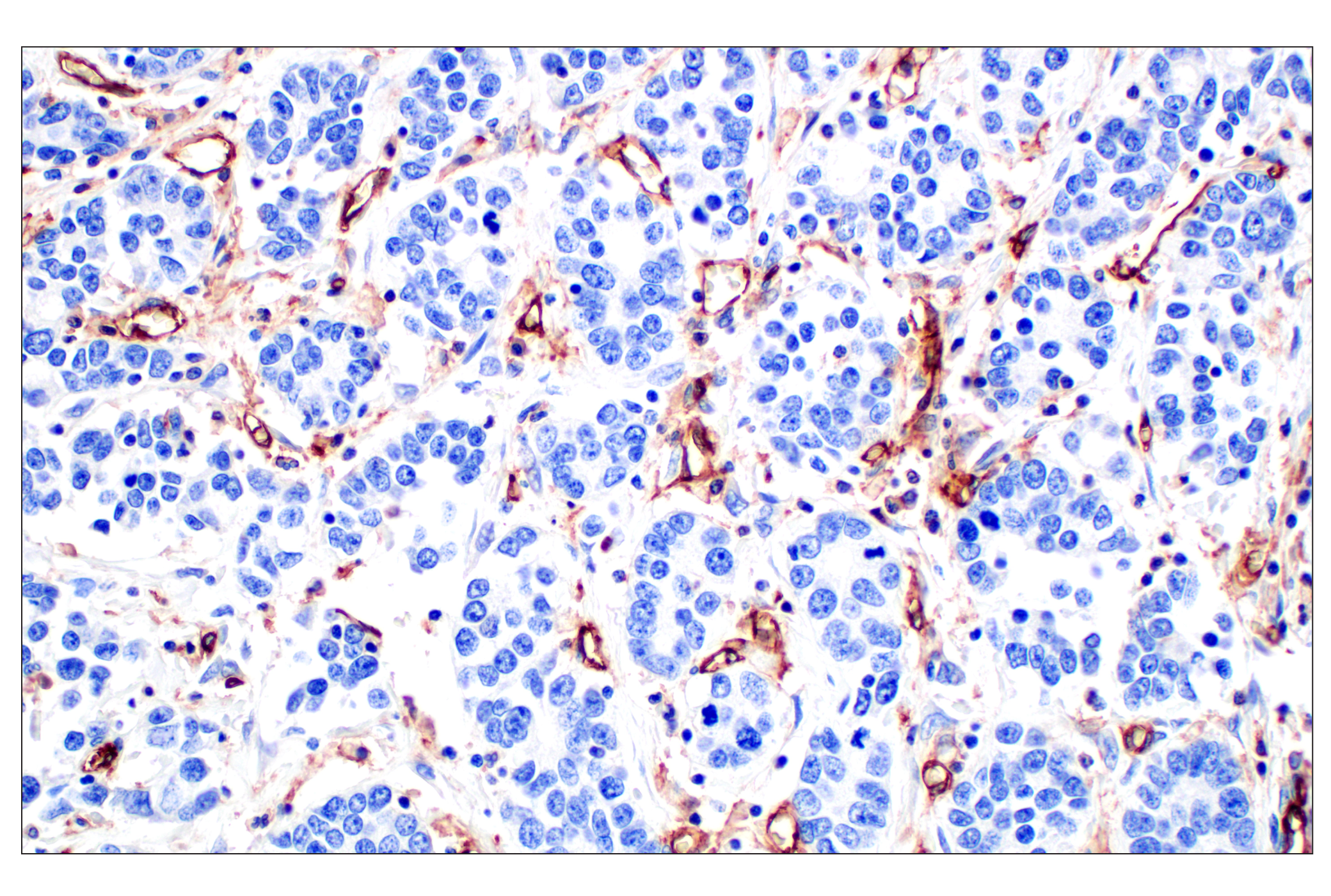 Immunohistochemistry Image 8: CD31 (PECAM-1) (F8M3S) Rabbit mAb