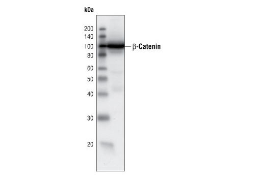 Western Blotting Image 2: β-Catenin Antibody